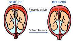 Embarazos múltiples Bebés gemelos y mellizos