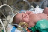 Convulsiones en el bebé prematuro
