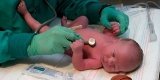 Distress transitorio en el bebé prematuro
